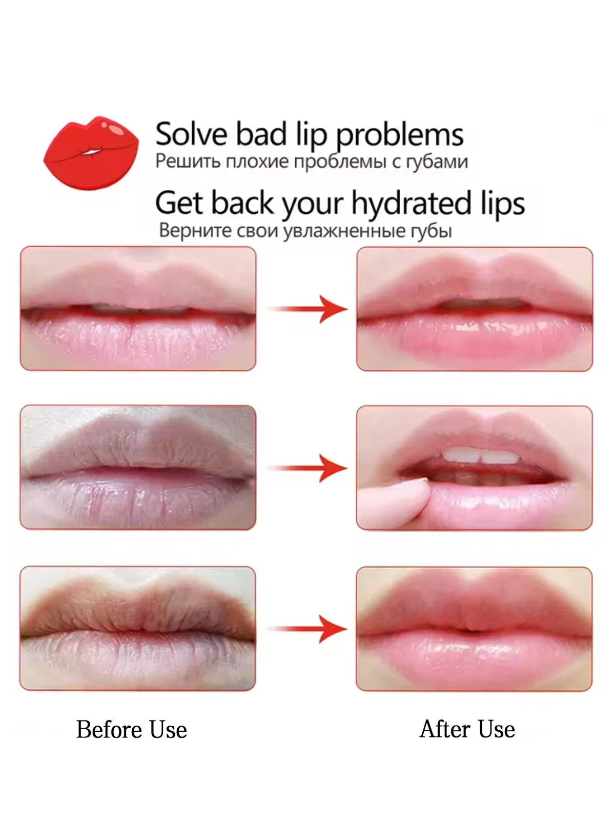 YOCITY Cherry Collagen Lip Mask Patches For Deep Hydration Repair